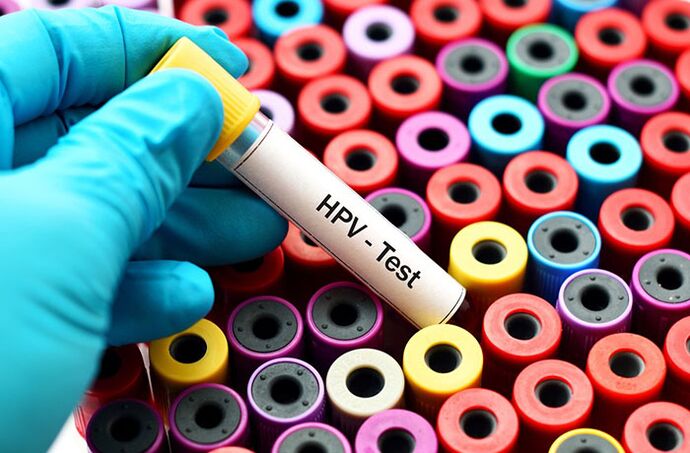 Krvný test na ľudský papilomavírus